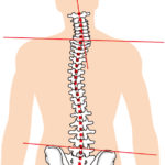 体の歪みが気になる、腰痛、脊柱管狭窄症、ヘルニアなど痛みにお悩みの方は、泉大津市の整体院 侍トレーナーズジャパンへ