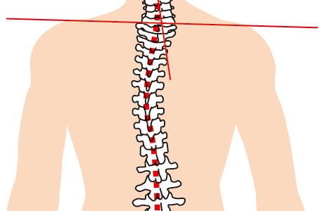 体の歪みが気になる、腰痛、脊柱管狭窄症、ヘルニアなど痛みにお悩みの方は、泉大津市の整体院　侍トレーナーズジャパンへ