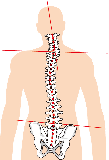 体の歪みが気になる、腰痛、脊柱管狭窄症、ヘルニアなど痛みにお悩みの方は、泉大津市の整体院 侍トレーナーズジャパンへ