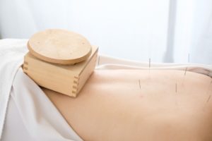 鍼灸で子宮内膜症が改善されない方向けに対応。泉大津市の整体院