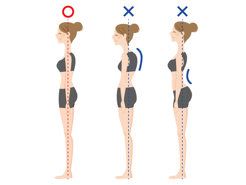 反り腰　猫背、骨盤前傾　骨盤後傾